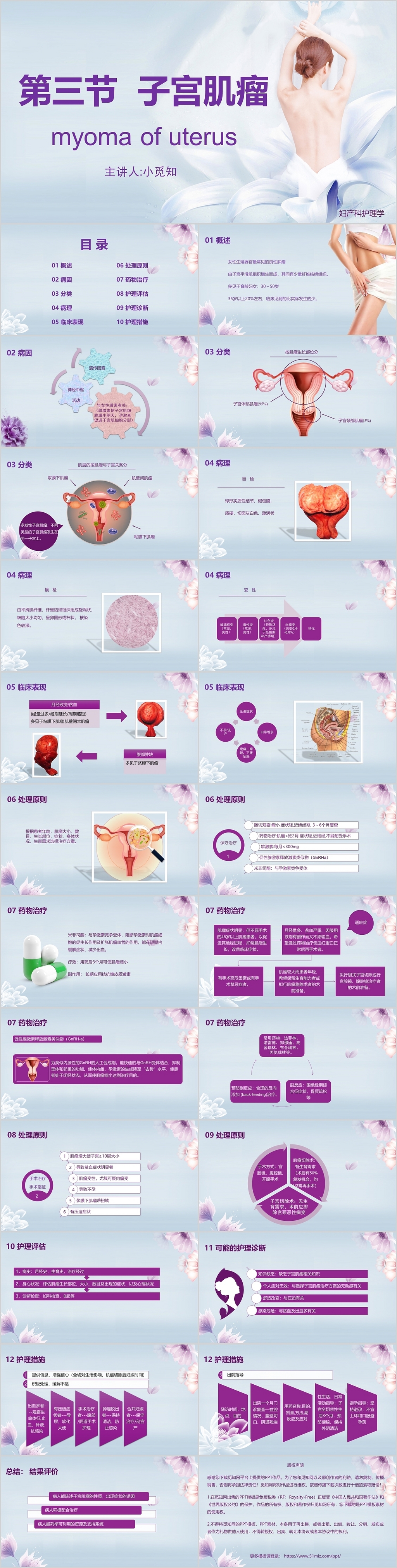 紫色清新子宫肌瘤护理查房PPT课件模板